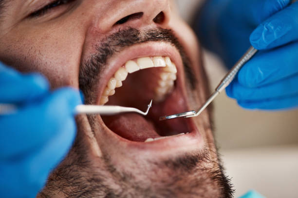 Best Tooth Infection Emergency Dentist  in Hanley Hills, MO